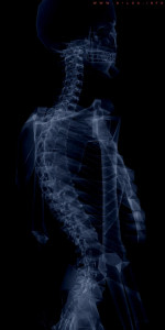 Constipation low back pain