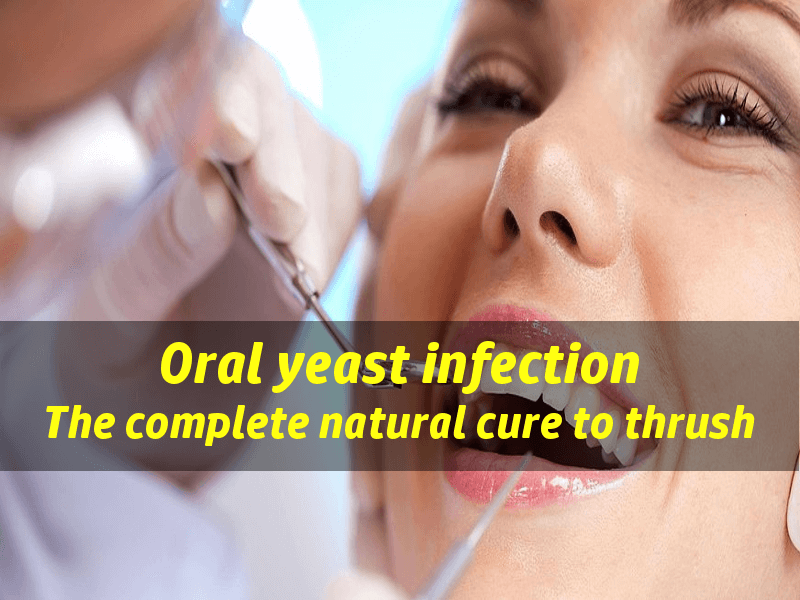 Yeast Infection In Mouth The Natural Treatment To Oral Thrush Mouth